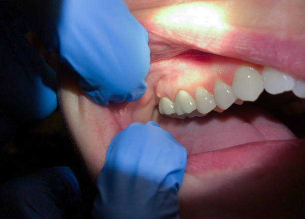 Best Emergency Dental Services for Seniors in South Lyon, MI