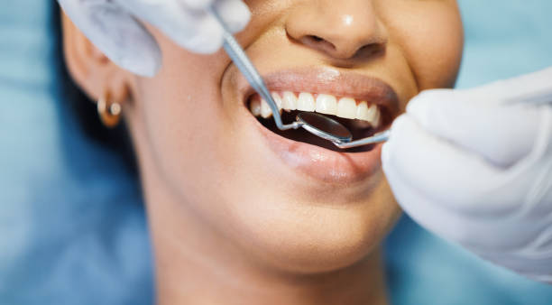 Best Broken or Cracked Tooth Emergency Dentist in South Lyon, MI