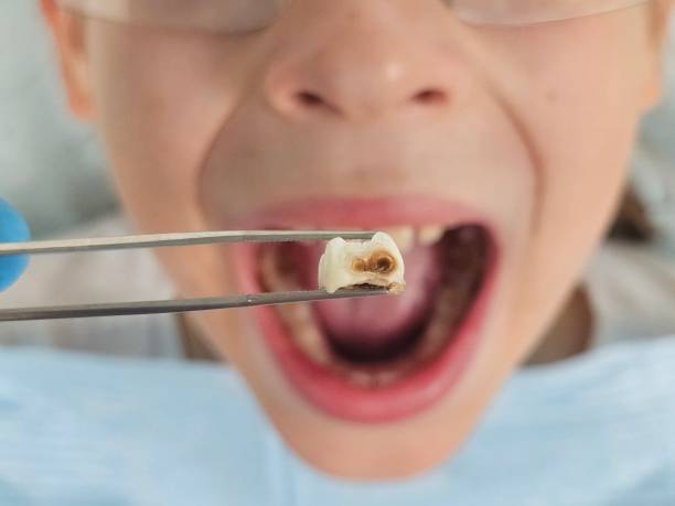 Best Emergency Dentist for Knocked-Out Tooth in South Lyon, MI